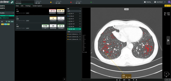 ▲AVIEW LCS Plus Summary page