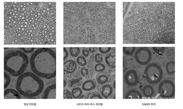 ▲이엔셀 핵심 파이프라인 'EN001' 치료 효과 설명 [사진출처=이엔셀 홈페이지]