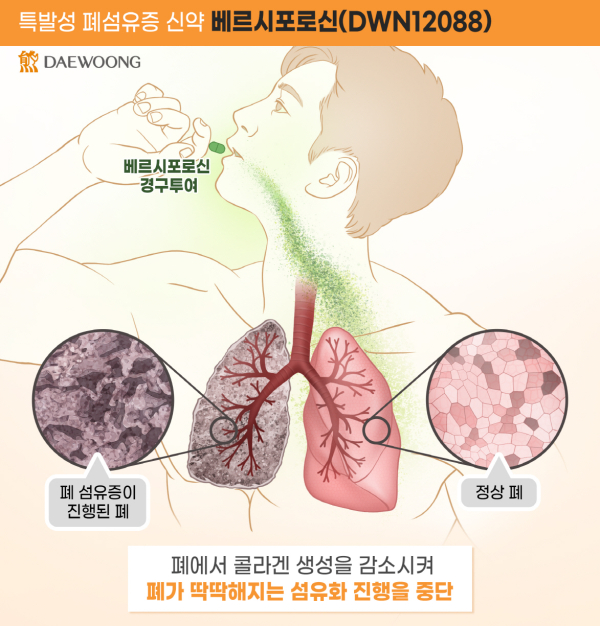 ▲ 대웅제약 베르시포로신(DWN12088) 작용 기전